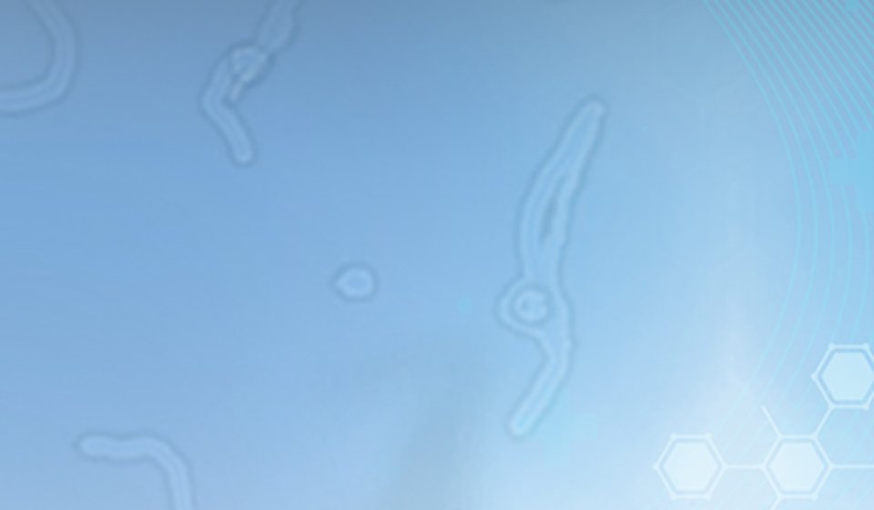 هل تختفي الذبابة الطائرة