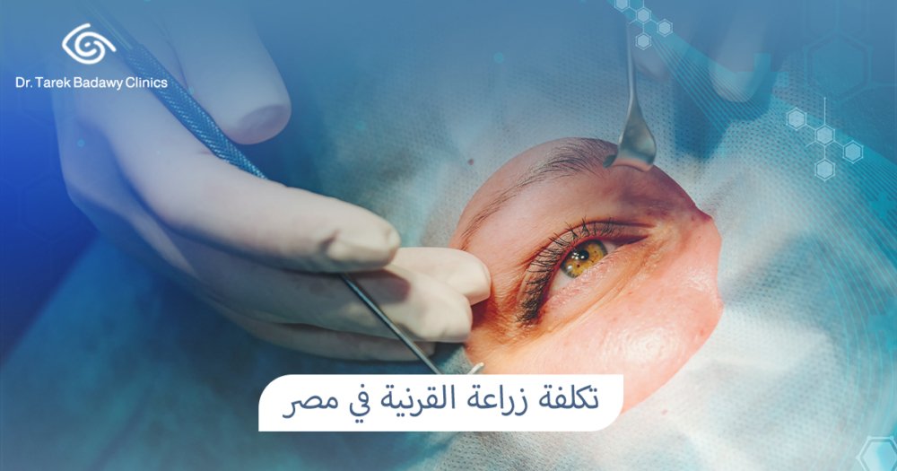 تكلفة زراعة القرنية في مصر