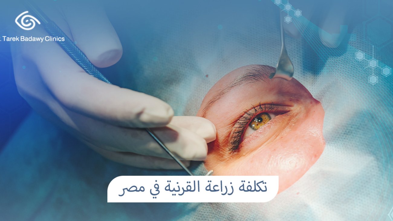 تكلفة زراعة القرنية في مصر