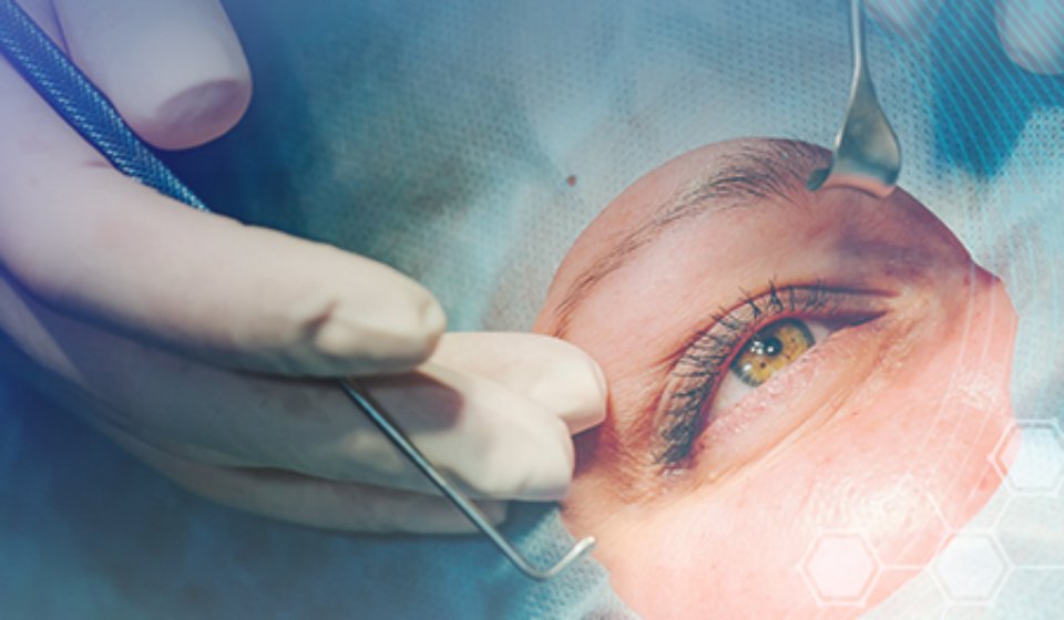 تكلفة زراعة القرنية في مصر