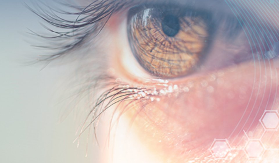 متى ينتهي جفاف العين بعد الليزر السطحي