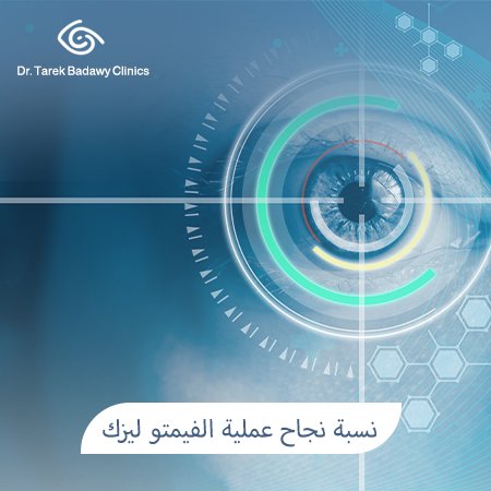 نسبة نجاح عملية الفيمتو ليزك